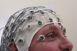 An EEG can be used to help make a diagnosis of seizure activity.