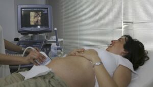 Fetal ultrasound can give a three dimensional view of the fetus before it is born. 